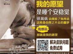 适今可讲述银屑病的病学原理