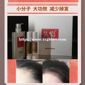 先彩养发  投资加盟 回本快..